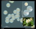 pseudomonas aeruginosa pyocyanin